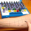 Allergy Testing